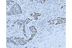 IHC analysis of MCM6 using anti-MCM6 antibody (ABIN7600037). (MCM6 抗体  (AA 14-821))