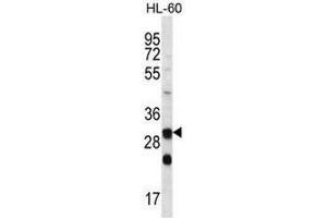 CA6 Antibody (C-term) western blot analysis in HL-60 cell line lysates (35µg/lane). (CA6 抗体  (C-Term))