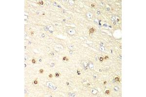 Immunohistochemistry of paraffin-embedded rat brain using HIF1AN antibody.