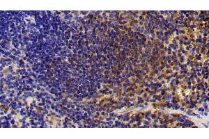 Detection of CTSS in Mouse Spleen Tissue using Polyclonal Antibody to Cathepsin S (CTSS) (Cathepsin S 抗体  (AA 115-331))