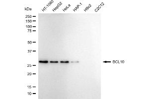 Western blotting analysis using BCL10 antibody (ABIN7800914). (Recombinant BCL10 Immune Signaling Adaptor 抗体)