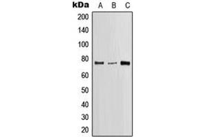 Western blot analysis of SLP76 expression in Jurkat (A), SP2/0 (B), H9C2 (C) whole cell lysates.