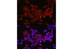 Immunofluorescence analysis of HeLa cells using Inhibin beta A (INHBA) Rabbit pAb (ABIN6129032, ABIN6142459, ABIN6142460 and ABIN6221533) at dilution of 1:50 (40x lens).