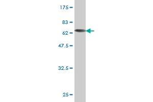 Western Blot detection against Immunogen (65. (ADA 抗体  (AA 1-363))