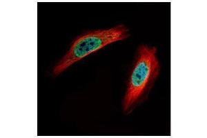 ICC/IF Image Confocal immunofluorescence analysis (Olympus FV10i) of paraformaldehyde-fixed HeLa, using CLIC4, antibody (Green) at 1:500 dilution. (CLIC4 抗体)
