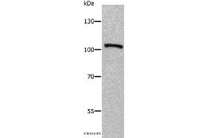 Western blot analysis of Human fetal brain tissue, using ADAMTS5 Polyclonal Antibody at dilution of 1:650 (ADAMTS5 抗体)