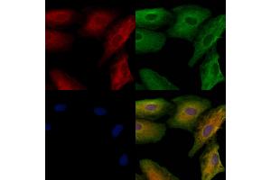 ABIN6259851 and ABIN6278727 staining  cells by IF/ICC.