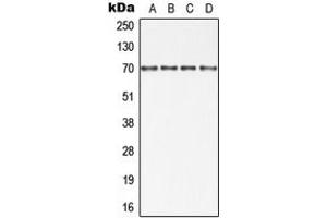 Western blot analysis of cIAP1 expression in HT29 (A), Jurkat (B), SP2/0 (C), PC12 (D) whole cell lysates. (BIRC2 抗体  (Center))