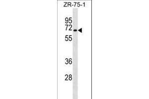 SG Antibody (C-term) (ABIN1537484 and ABIN2849754) western blot analysis in ZR-75-1 cell line lysates (35 μg/lane). (C9orf96 抗体  (C-Term))