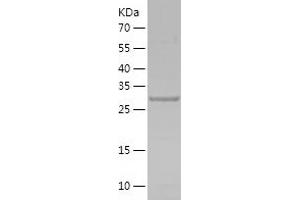 Western Blotting (WB) image for Insulin-Like Growth Factor Binding Protein 7 (IGFBP7) (AA 27-282) protein (His tag) (ABIN7123465) (IGFBP7 Protein (AA 27-282) (His tag))