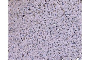 IHC analysis of DLAT using anti-DLAT antibody (ABIN7602307).