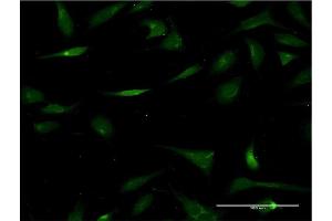 Immunofluorescence of monoclonal antibody to CHST3 on HeLa cell.