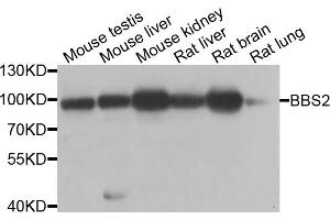 Western blot analysis of extracts of various cell lines, using BBS2 antibody. (BBS2 抗体)