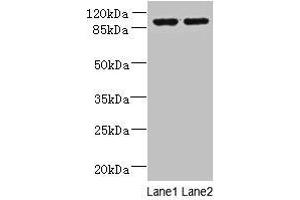 Western blot All lanes: EFHB antibody at 4 μg/mL Lane 1: HepG2 whole cell lysate Lane 2: PC-3 whole cell lysate Secondary Goat polyclonal to rabbit IgG at 1/10000 dilution Predicted band size: 94, 71, 80 kDa Observed band size: 94 kDa (EFHB 抗体  (AA 405-644))
