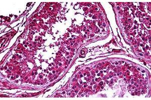 Human Testis: Formalin-Fixed, Paraffin-Embedded (FFPE) (PDK2 抗体  (AA 187-276))