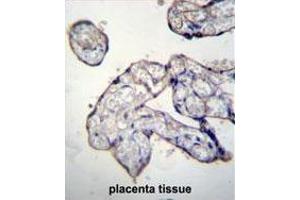Immunohistochemistry (Paraffin-embedded Sections) (IHC (p)) image for anti-Thyroid Hormone Receptor Interactor 13 (TRIP13) (AA 370-400), (C-Term) antibody (ABIN955331)