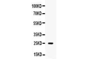 Western blot analysis of Elafin/Skalp expression in human placenta extract ( Lane 1). (PI3 抗体  (AA 61-117))
