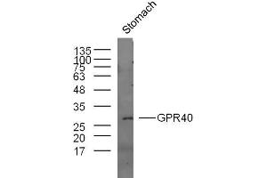 Mouse stomach lysates probed with GPR40 Polyclonal Antibody, unconjugated  at 1:300 overnight at 4°C followed by a conjugated secondary antibody at 1:10000 for 60 minutes at 37°C. (FFAR1 抗体  (AA 121-220))