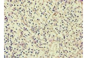 Immunohistochemistry of paraffin-embedded human spleen tissue using ABIN7144082 at dilution of 1:100 (AGGF1 抗体  (AA 1-70))