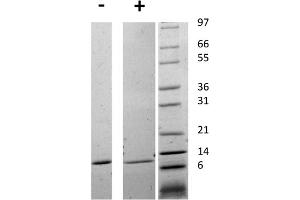 SDS-PAGE of Human MigSDS-PAGE of Ration Inhibitory Factor Recombinant Protein SDS-PAGE of Human Migration Inhibitory Factor Recombinant Protein. (MIF 蛋白)