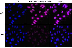 Immunocytochemical staining of HepG2 cells using Phospho-EGFR (Tyr) antibody (ABIN7798465), 1:1,000), Top panel: wild-type (WT), Bottom panal: Phospho-EGFR (Tyr) shRNA knockdown (KD). (Recombinant EGFR 抗体  (pTyr1068))