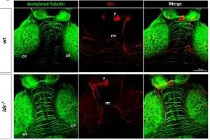 Immunofluorescence (IF) image for anti-Deleted in Colorectal Carcinoma (DCC) (Middle Region) antibody (ABIN2782671)