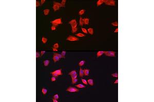 Immunofluorescence analysis of Hep G2 cells using GAMT Rabbit pAb (ABIN6130447, ABIN6140950, ABIN6140951 and ABIN6222280) at dilution of 1:200 (40x lens). (GAMT 抗体  (AA 1-236))