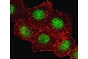 Fluorescent image of A549 cell stained with CREB antibody. (CREB1 抗体  (AA 105-132))
