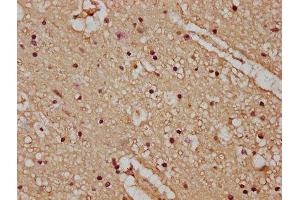 Immunohistochemistry (IHC) image for anti-ATPase, Ca++ Transporting, Plasma Membrane 4 (ATP2B4) (AA 281-345) antibody (ABIN7163520)