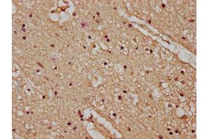 IHC image of ABIN7163520 diluted at 1:100 and staining in paraffin-embedded human brain tissue performed on a Leica BondTM system. (ATP2B4 抗体  (AA 281-345))