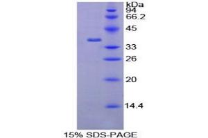 SDS-PAGE analysis of Rat AATF Protein. (AATF 蛋白)