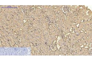 Immunohistochemistry of paraffin-embedded Rat kidney tissue using ACTA2 Monoclonal Antibody at dilution of 1:200. (Smooth Muscle Actin 抗体)