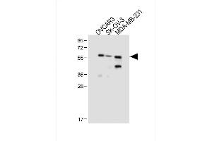 All lanes : Anti-HR2 Antibody (N-term) at 1:1000 dilution Lane 1: OVCAR3 whole cell lysate Lane 2: SK-OV-3 whole cell lysate Lane 3: MDA-MB-231 whole cell lysate Lysates/proteins at 20 μg per lane. (AMHR2 抗体  (N-Term))