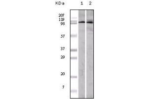 Western blot analysis using EphA1 antibody against A549 (1) and Hela (2) cell lysate. (EPHA1 抗体)