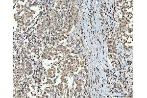 IHC analysis of SMC6 using anti-SMC6 antibody (ABIN7601864).