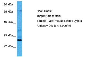 Host:  Mouse  Target Name:  MSLN  Sample Tissue:  Mouse Kidney  Antibody Dilution:  1ug/ml (Mesothelin 抗体  (Middle Region))
