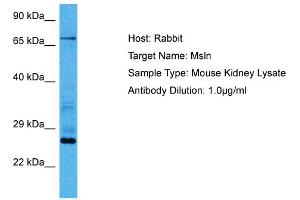 Host:  Mouse  Target Name:  MSLN  Sample Tissue:  Mouse Kidney  Antibody Dilution:  1ug/ml (Mesothelin 抗体  (Middle Region))