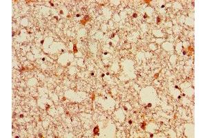 Immunohistochemistry of paraffin-embedded human brain tissue using ABIN7152811 at dilution of 1:100 (FGF22 抗体  (AA 23-170))