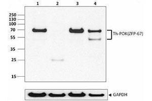 Western Blotting (WB) image for anti-Th-POK antibody (ABIN2665409) (Th-POK 抗体)