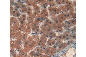 Used in DAB staining on fromalin fixed paraffin- embedded liver tissue (MDH2 抗体  (AA 25-338))