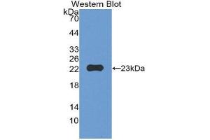 Western Blotting (WB) image for anti-Matrix Metallopeptidase 12 (Macrophage Elastase) (MMP12) (AA 294-473) antibody (ABIN1172854) (MMP12 抗体  (AA 294-473))