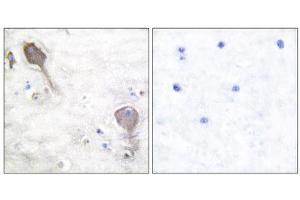 Immunohistochemistry (IHC) image for anti-Parkinson Protein 2, E3 Ubiquitin Protein Ligase (Parkin) (PARK2) (N-Term) antibody (ABIN1848726) (Parkin 抗体  (N-Term))