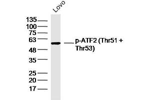 LOVO lysates probed with p-ATF2 (Thr51 + Thr53) Polyclonal Antibody, Unconjugated  at 1:300 dilution and 4˚C overnight incubation. (ATF2 抗体  (pThr51, pThr53))