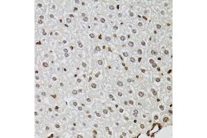 Immunohistochemistry of paraffin-embedded mouse liver using KDM4A antibody (ABIN6131821, ABIN6142793, ABIN6142795 and ABIN6223960) at dilution of 1:100 (40x lens). (KDM4A 抗体  (AA 585-815))