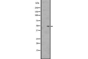 Western blot analysis of SS3R expression in Fetal Kidney Lysate,The lane on the left is treated with the antigen-specific peptide. (SSTR3 抗体  (C-Term))