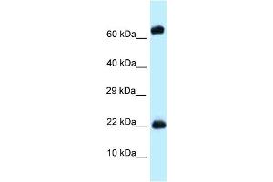 WB Suggested Anti-Zfp580 Antibody Titration: 1. (ZNF580 抗体  (Middle Region))