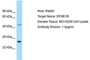 Image no. 1 for anti-Eukaryotic Translation Initiation Factor 4E Family Member 1B (EIF4E1B) (AA 114-163) antibody (ABIN6749878)