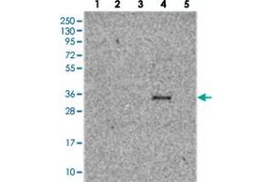 Western blot analysis of Lane 1: RT-4, Lane 2: U-251 MG, Lane 3: Human Plasma, Lane 4: Liver, Lane 5: Tonsil with TMUB2 polyclonal antibody  at 1:250-1:500 dilution. (TMUB2 抗体)