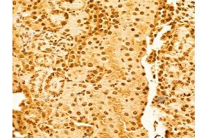 ABIN6263918 and ABIN6273062 at 1/100 staining Rat kidney tissue by IHC-P.