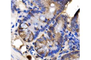 IHC analysis of LSR using anti-LSR antibody (ABIN7599514).